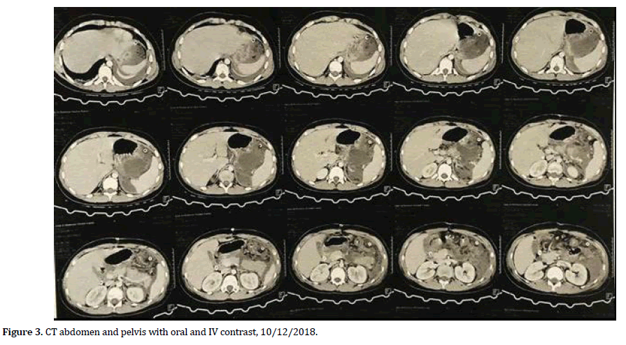 pancreas-ct-abdomen