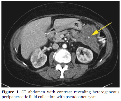 pancreas-ct-abdomen-contrast-