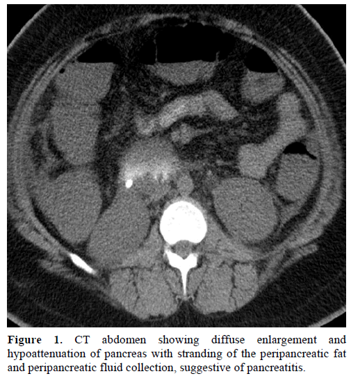 pancreas-ct-abdomen-diffuse-enlargement