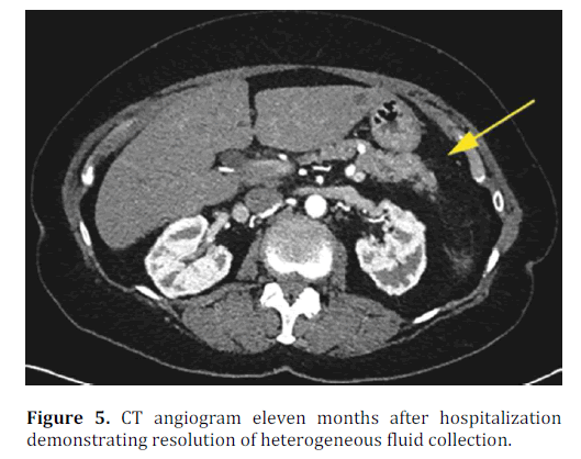 pancreas-ct-angiogram-eleven-months