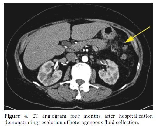 pancreas-ct-angiogram-four-months