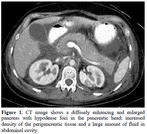 pancreas-ct-image-diffusely-enhancing