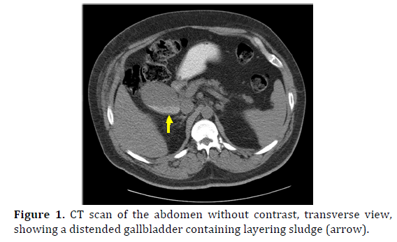 pancreas-ct-scan-abdomen-contrast