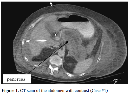pancreas-ct-scan-abdomen-contrast-case1