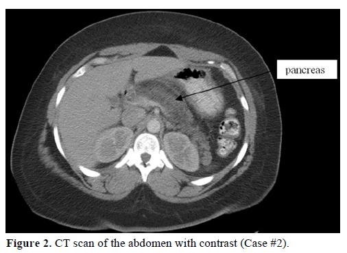pancreas-ct-scan-abdomen-contrast-case2