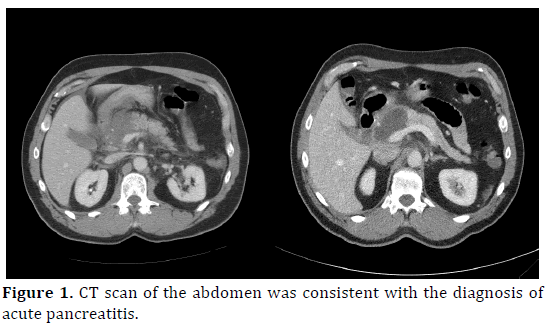 pancreas-ct-scan-abdomen-diagnosis