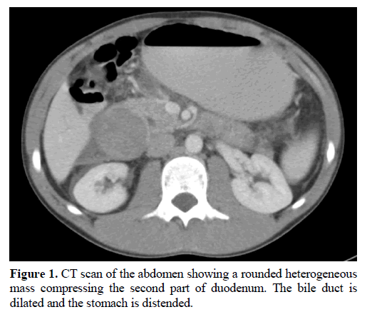pancreas-ct-scan-abdomen-heterogeneous