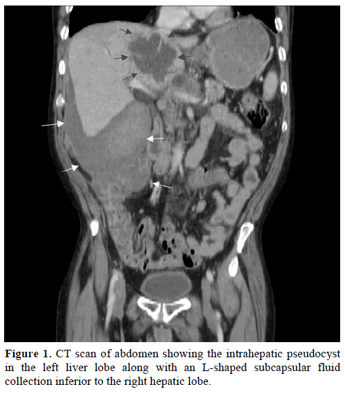 pancreas-ct-scan-abdomen-intrahepatic