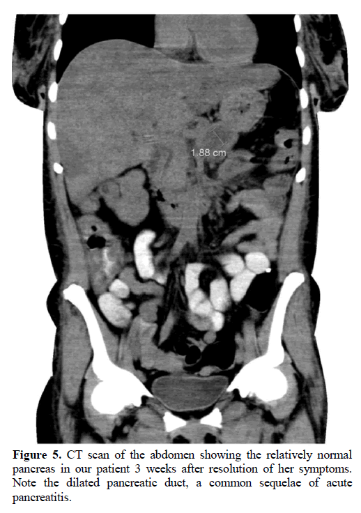 pancreas-ct-scan-abdomen-pancreas