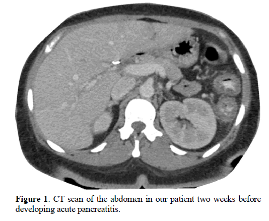 pancreas-ct-scan-abdomen-patient