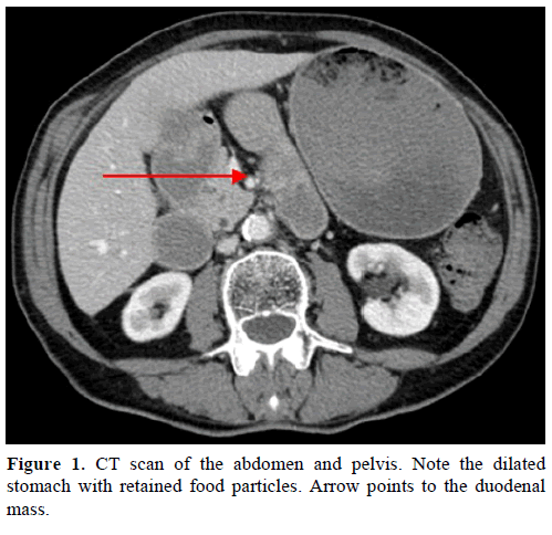 pancreas-ct-scan-abdomen-pelvis
