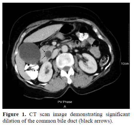pancreas-ct-scan-image-demonstrating