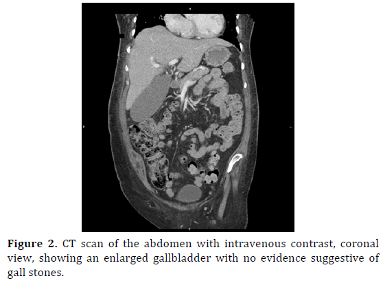 pancreas-ct-scan-intravenous-contrast