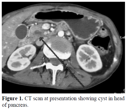 pancreas-ct-scan-presentation-pancreas