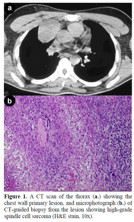 pancreas-ct-scan-thorax-chest-wall