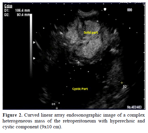 pancreas-curved-linear-array-complex