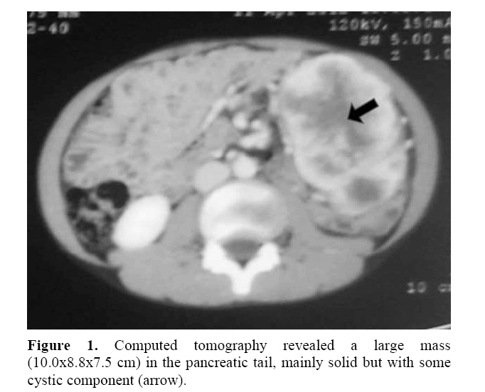 pancreas-cystic-component-arrow