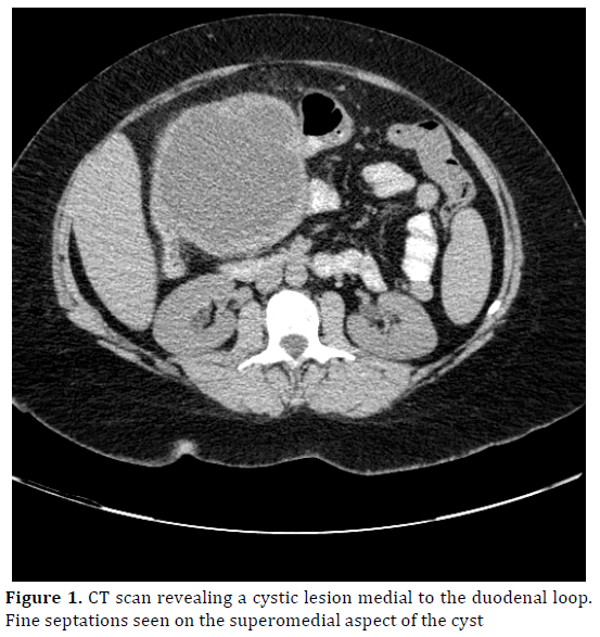 pancreas-cystic-lesion-medial