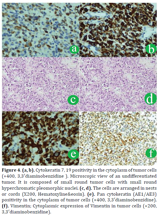 pancreas-cytokeratin-cytoplasm