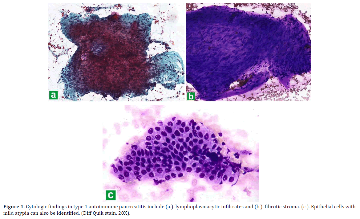 pancreas-cytologic-findings-autoimmune