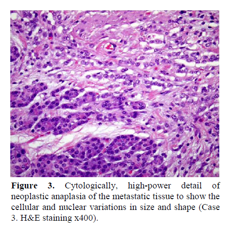 pancreas-cytologically-high-power