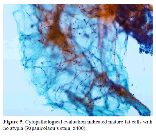 pancreas-cytopathological-evaluation