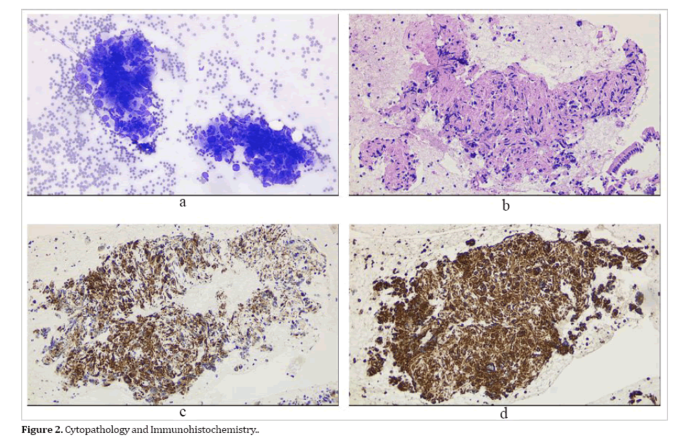 pancreas-cytopathology-immunohistochemistry