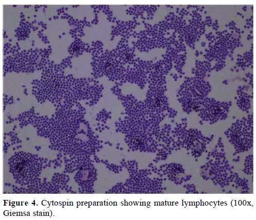 pancreas-cytospin-preparation-lymphocytes