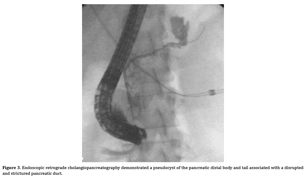 pancreas-demonstrated