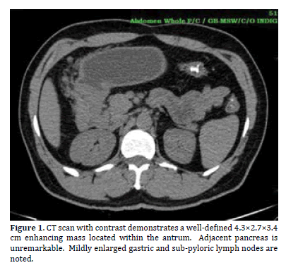 pancreas-demonstrates