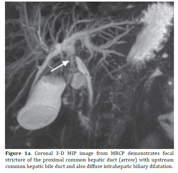 pancreas-demonstrates