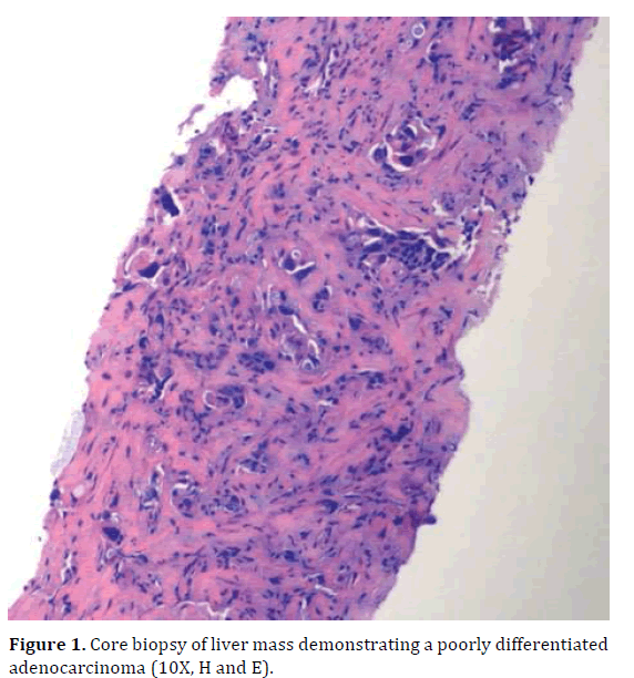 pancreas-demonstrating