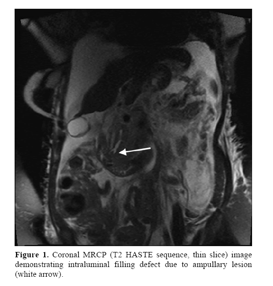 pancreas-demonstrating-intraluminal