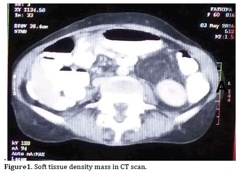 pancreas-density