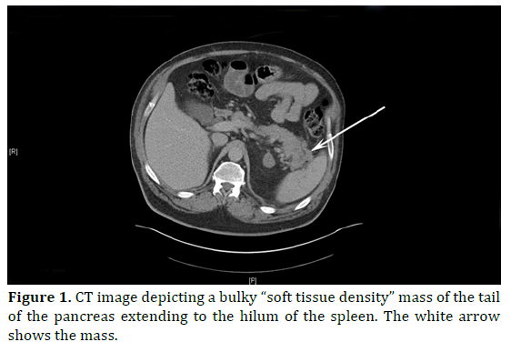 pancreas-depicting-soft-tissue-density