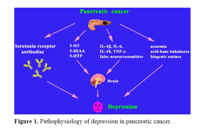 pancreas-depression-pancreatic-cancer