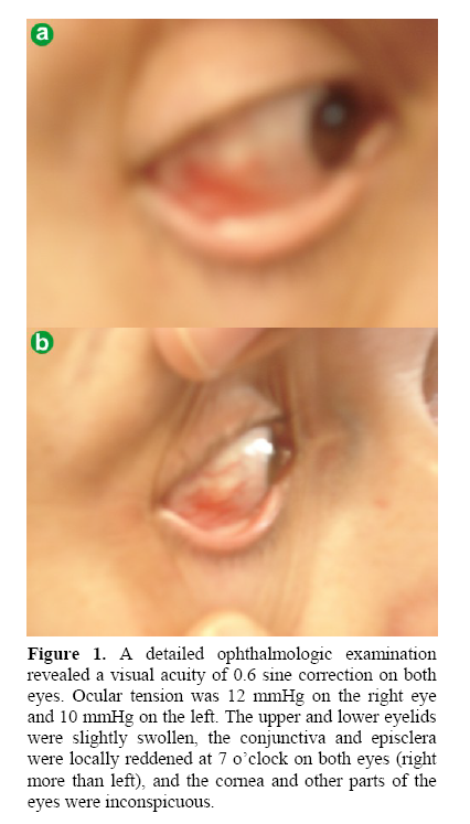 pancreas-detailed-ophthalmologic-examination