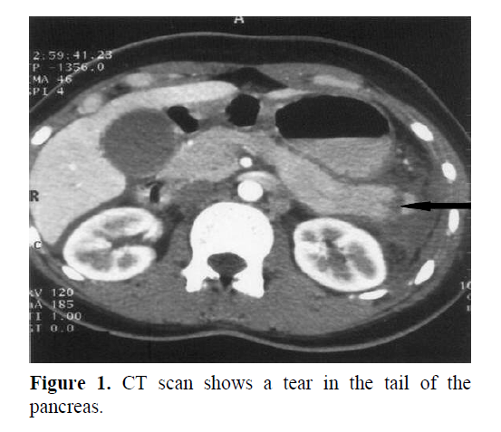 pancreas-determined-semiquantitative