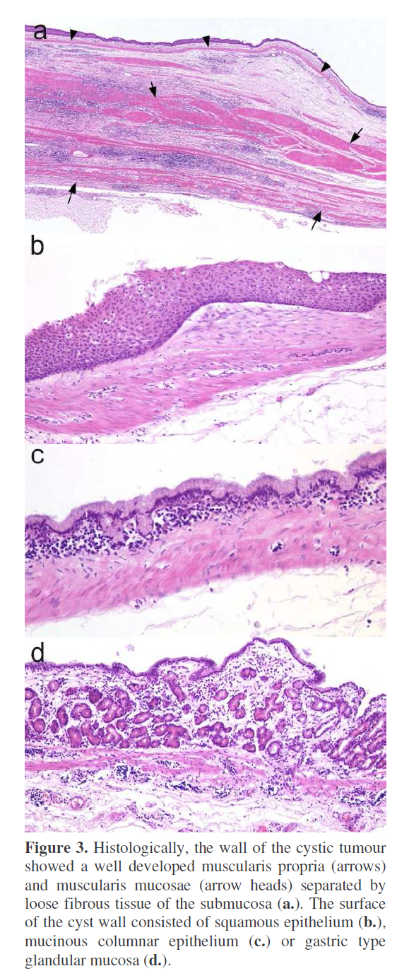 pancreas-developed-muscularis-propria