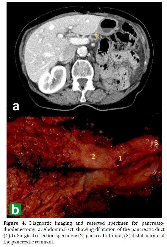 pancreas-diagnostic-imaging-specimen