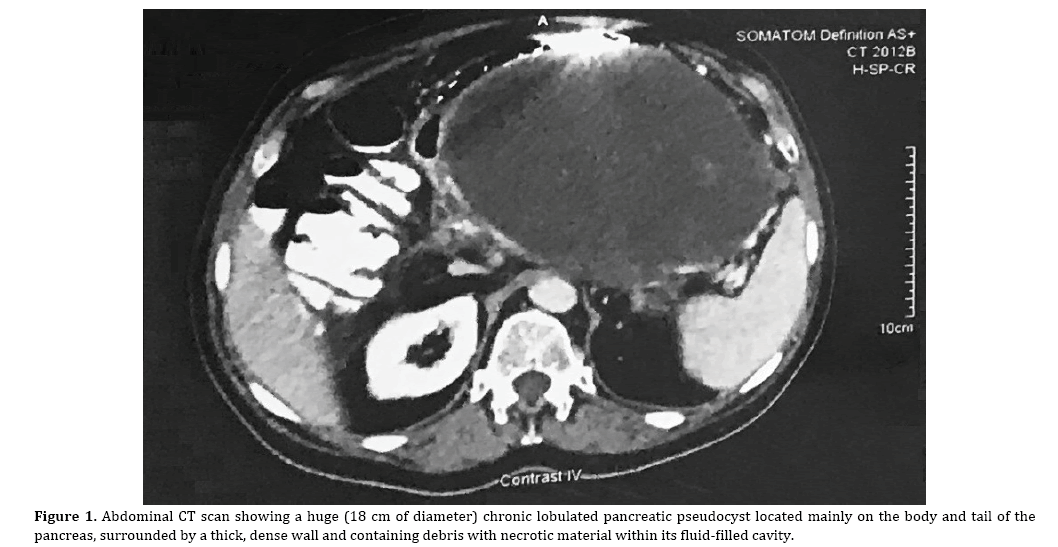 pancreas-diameter