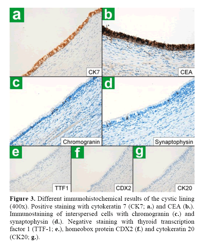 pancreas-different-immunohistochemical