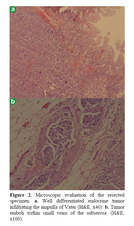 pancreas-differentiated-endocrine