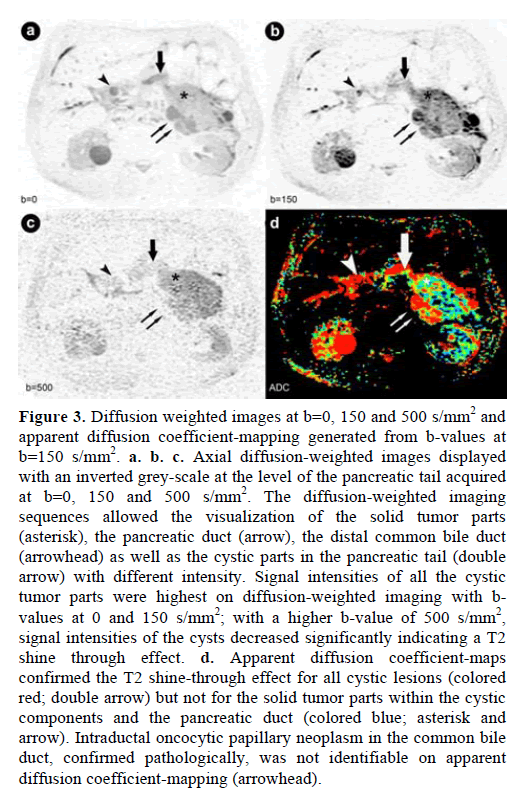 pancreas-diffusion-weighted-images