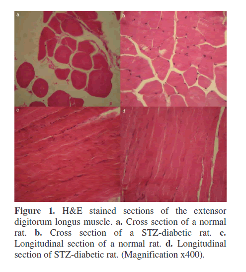 pancreas-digitorum-longus-muscle