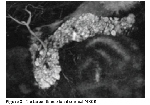 pancreas-dimensional