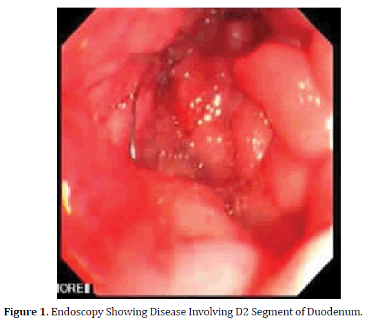pancreas-disease-involving