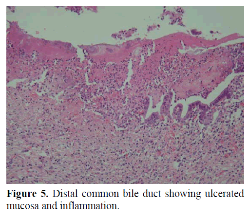 pancreas-distal-common-bile-duct-mucosa