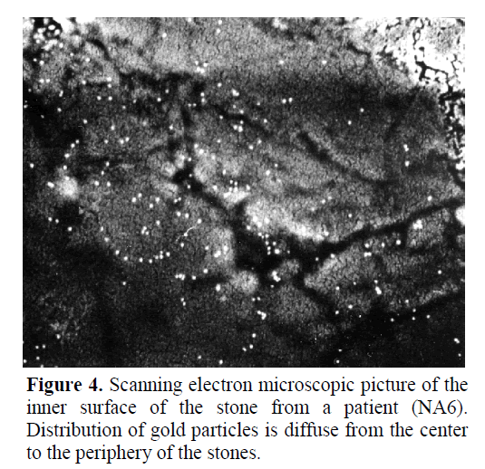 pancreas-distribution-gold-particles