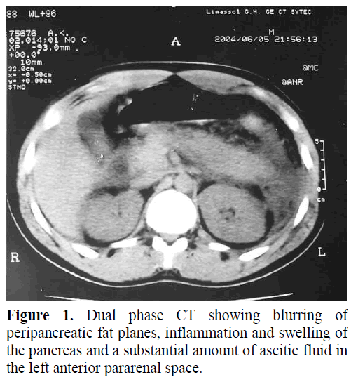 pancreas-dual-phase-ct-peripancreatic